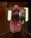 Che FTM STP 2&1 STP Prosthetic